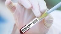 corona vaccine-4946480 960 720